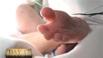99 Balloons: From Igniter Videos, Vol 05 - 